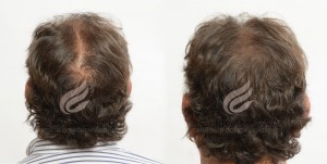 capelli prima e dopo