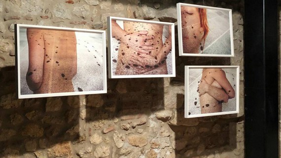La Bellezza Resta all’Aquila