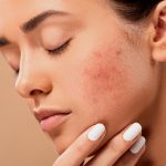 Skin care e Cannabis, un naturale connubio per la salute della pelle